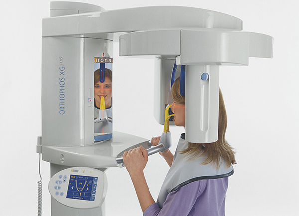 Scanner 3D