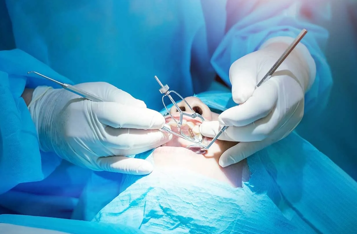 Chirurgie Orale